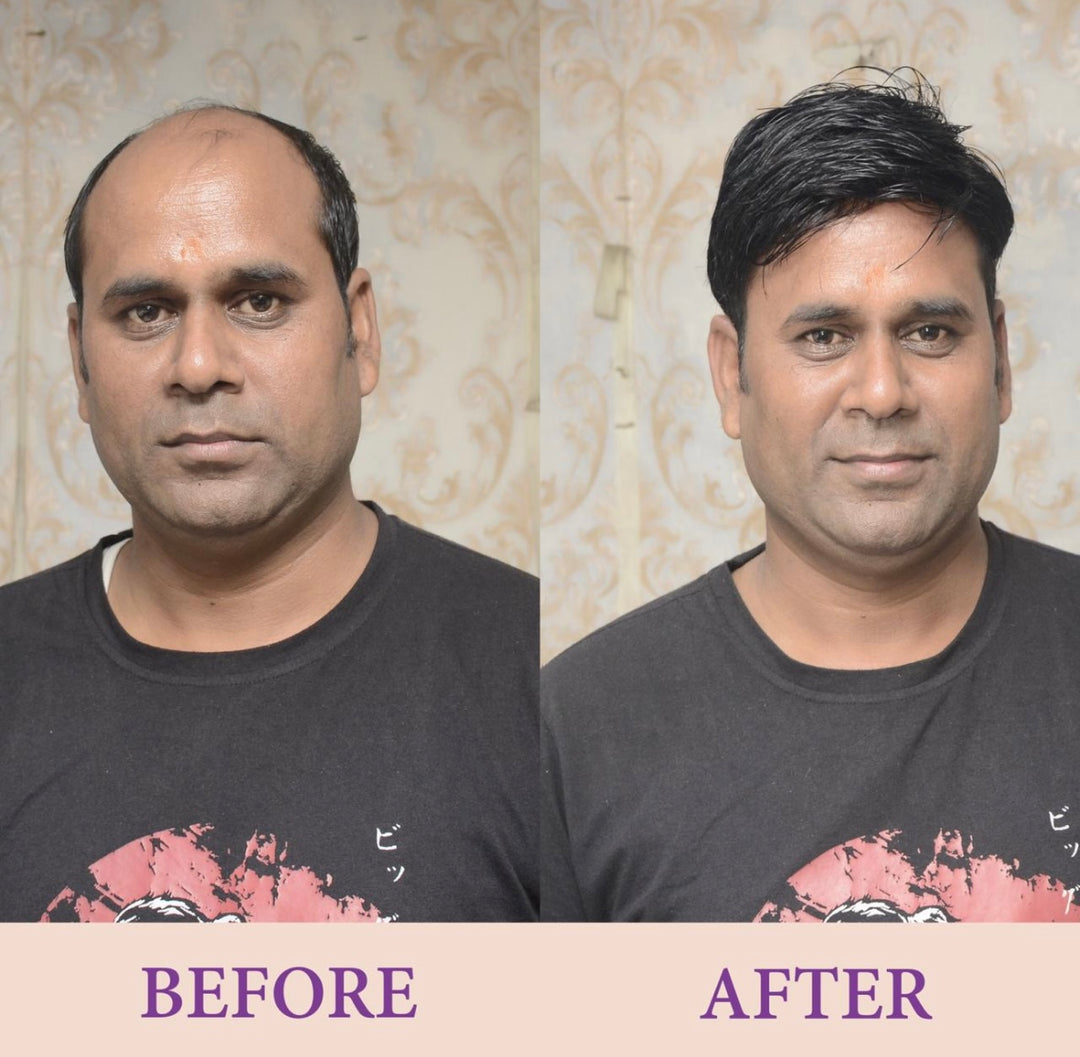 Best beaux men hair patch near me