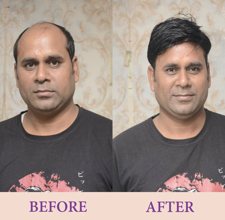 Best beaux men hair patch near me