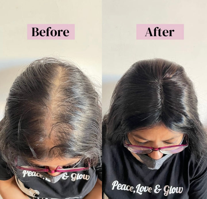mono base hair topper near me