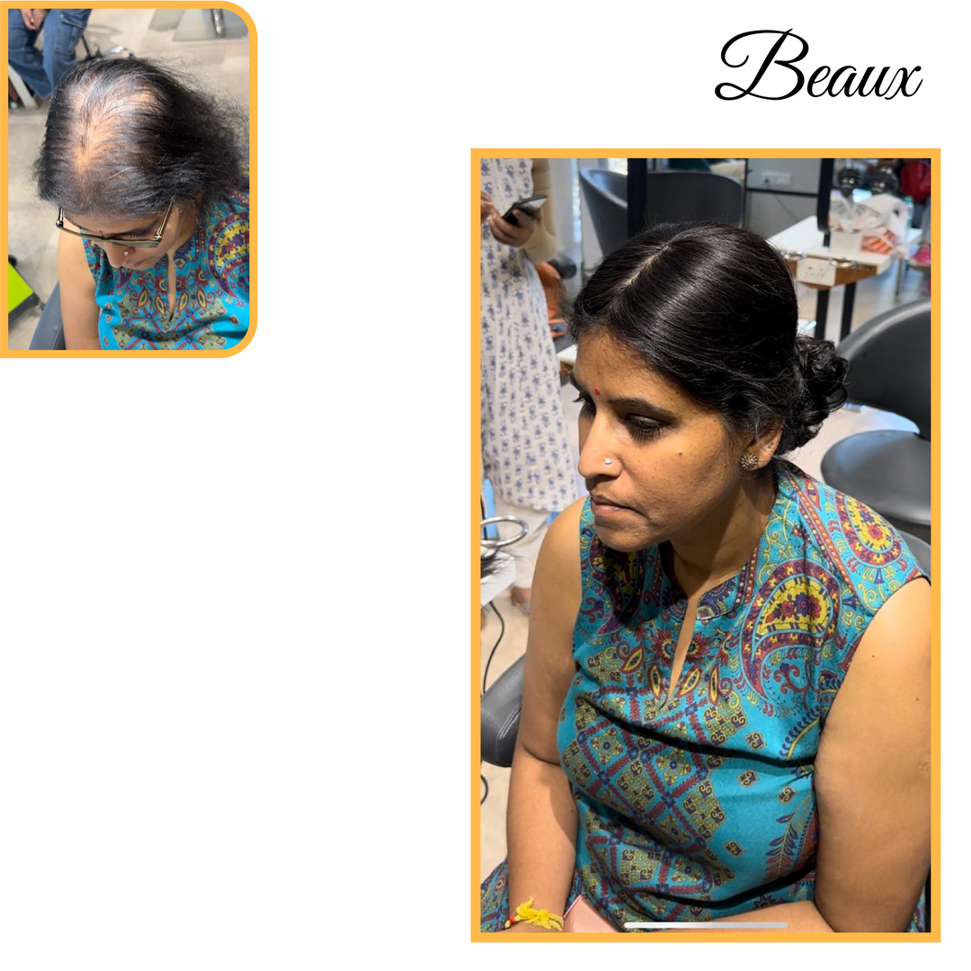 Shortest Hair Topper ( 100% human hair )
