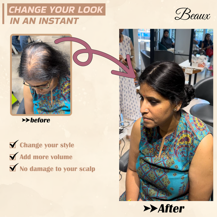 Shortest Hair Topper ( 100% human hair )