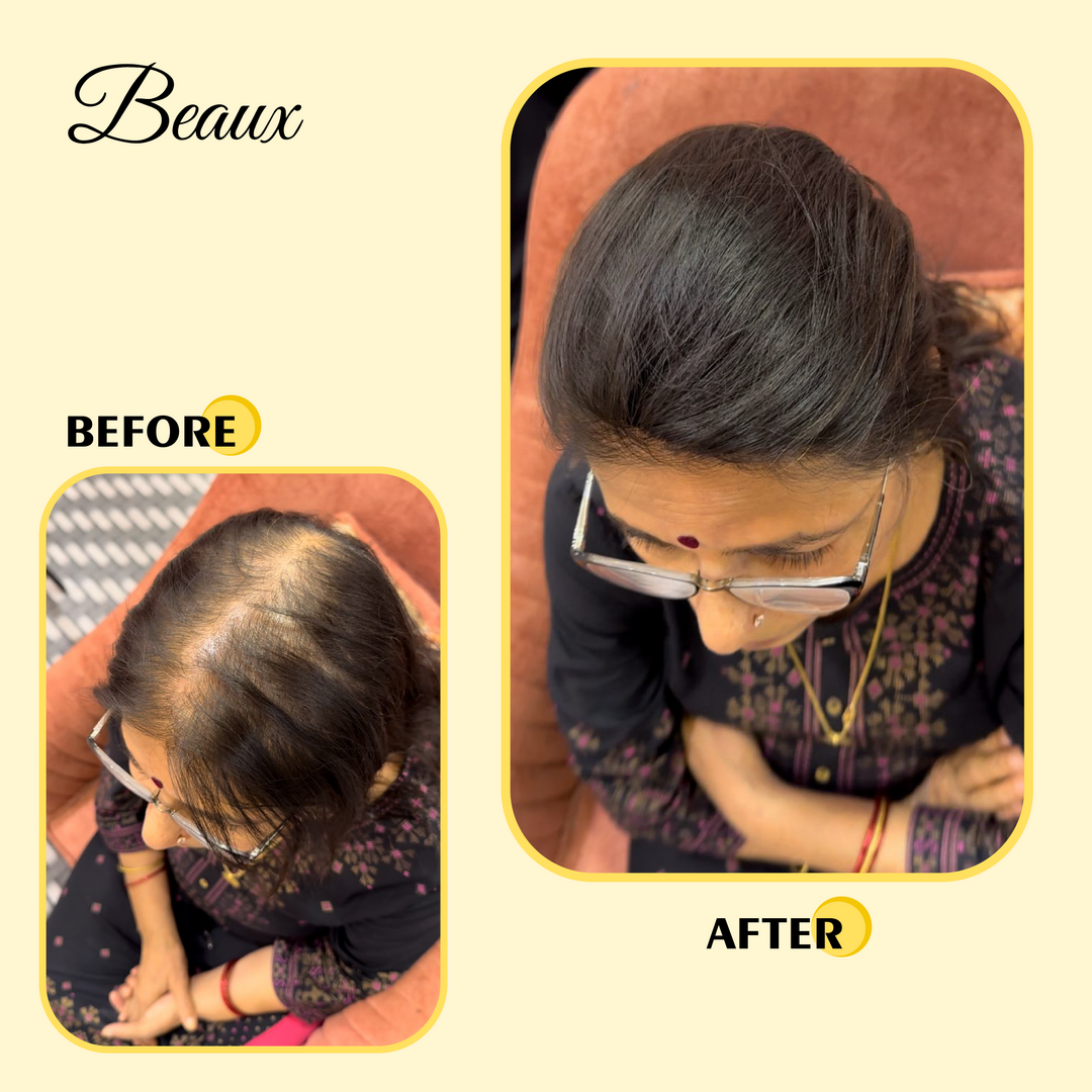 Shortest Hair Topper ( 100% human hair )