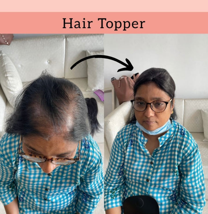mono top hair toppers