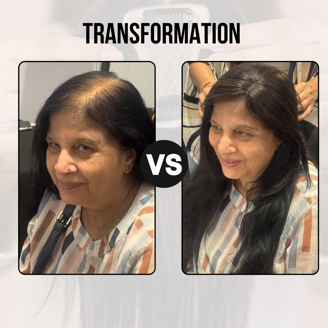 Mini Scalp Topper ( 100% human hair )