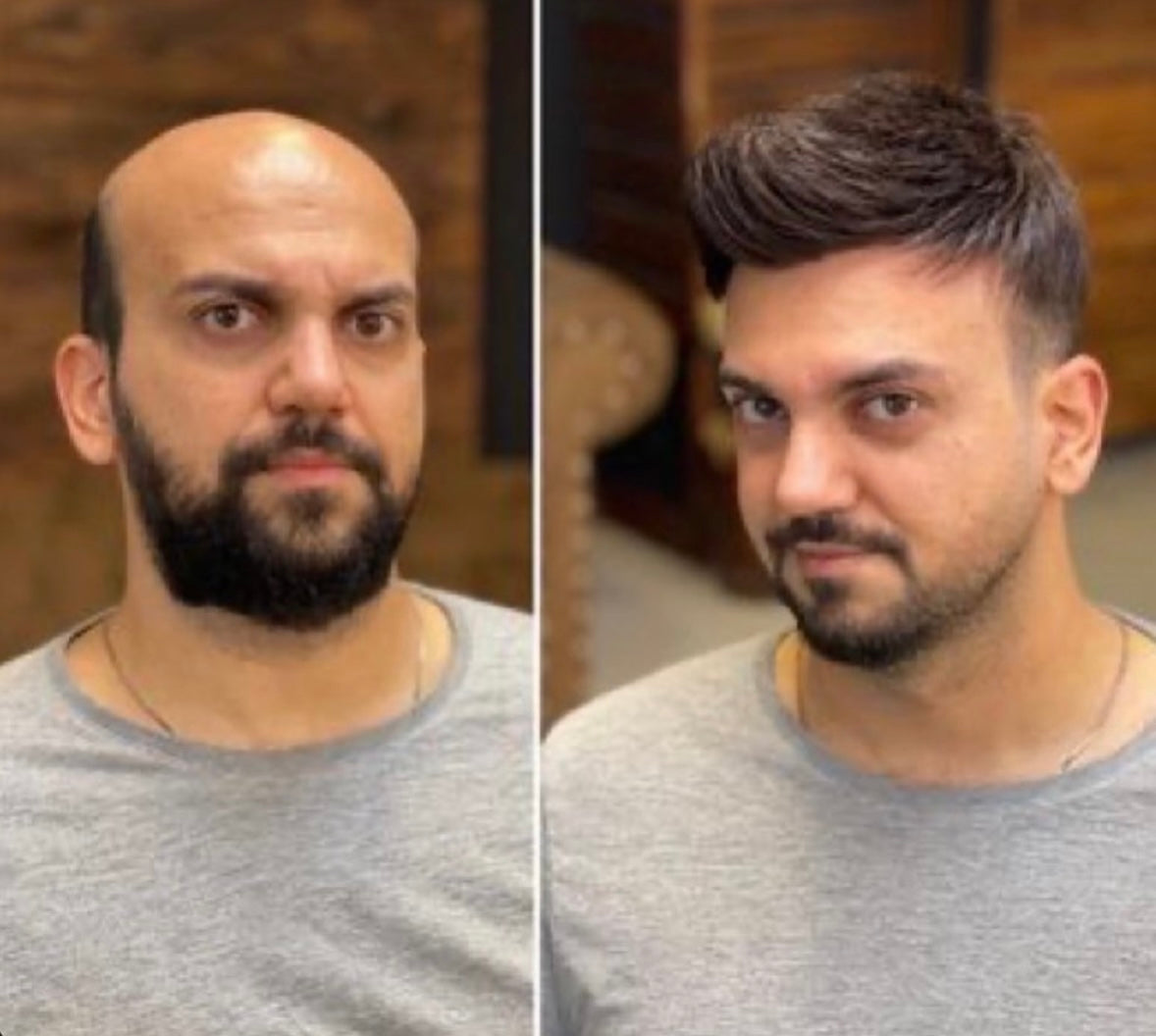 Hair patch for men sales